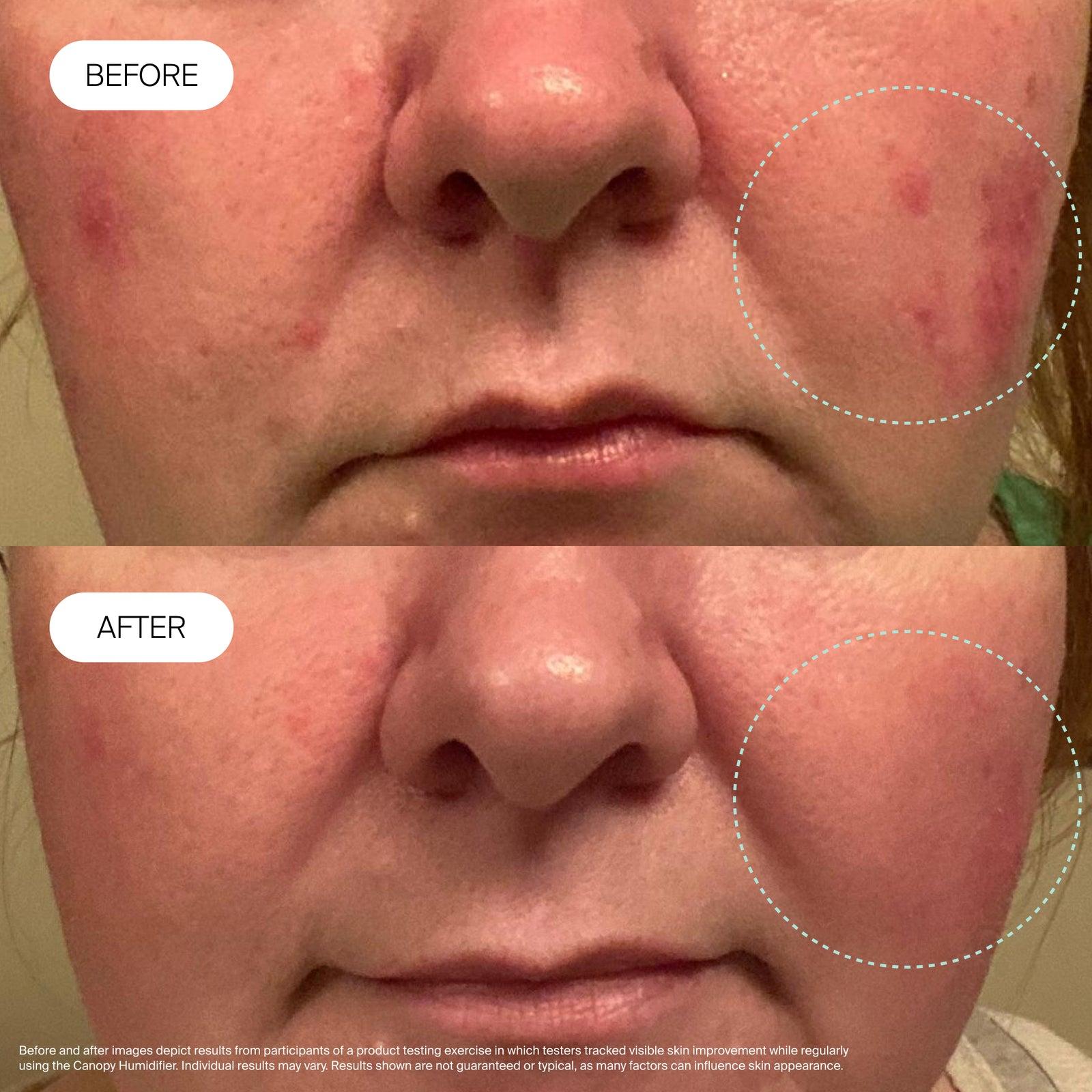 Before and after skin hydration comparison