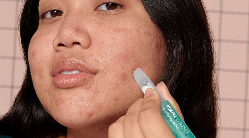 Pimple Correct vs. Mighty Patch: What’s the Difference Between these Skincare Products?