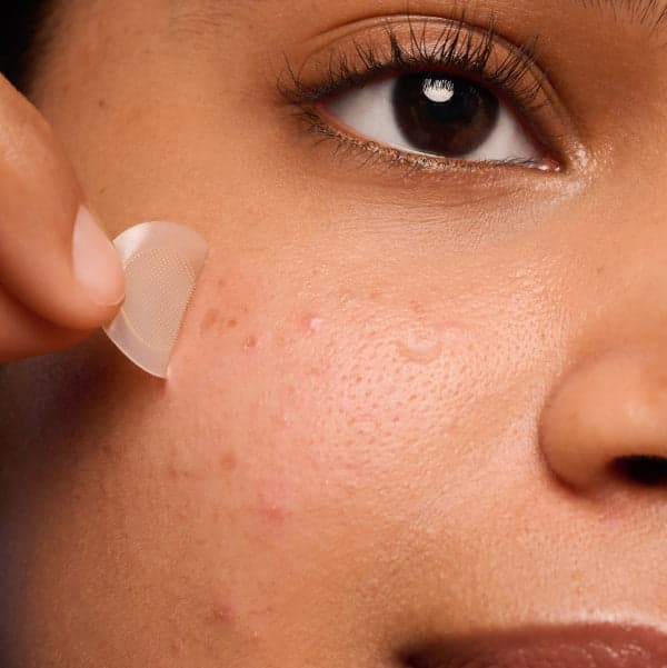 Mighty Patch™ for Dark Spots